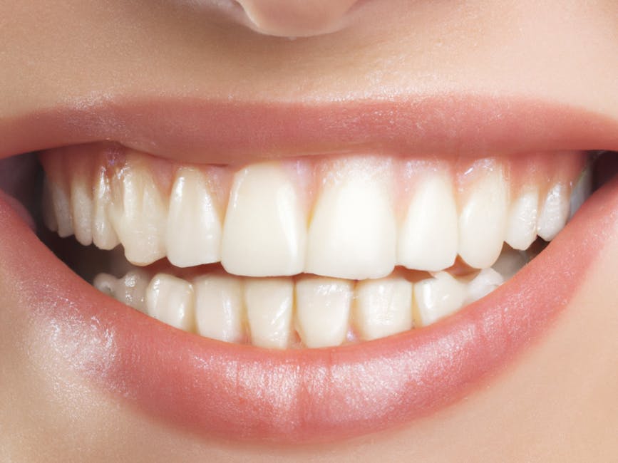 Smile Design